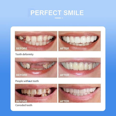Snap On Smile | Snap On. Smile On