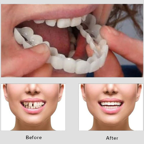 Snap On Smile | Snap On. Smile On