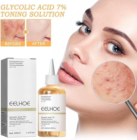 Eelhoe - Glycolic Acid 7% Toning Solution | Refresh. Smooth. Reveal Your Glow.