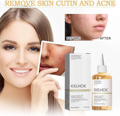 Eelhoe - Glycolic Acid 7% Toning Solution | Refresh. Smooth. Reveal Your Glow.